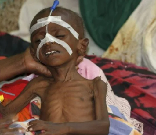 Criança recebendo tratamento médico